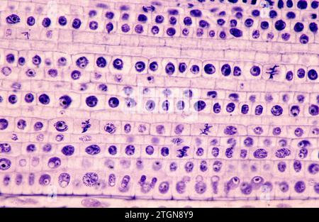 Il meristem apicale della radice mostra le divisioni cellulari (mitosi). Fotomicrografia della radice di cipolla. Foto Stock