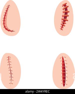 Le icone di sutura operative impostano il vettore dei cartoni animati. Vari tipi di sutura chirurgica. Chirurgia, concetto di medicina Illustrazione Vettoriale