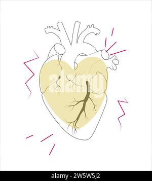 Cuore umano con linee a zigzag cardiogramma e forma geometrica del cuore in stile minimalista e alla moda per decorare o disegnare il logo. Illustrazione Vettoriale