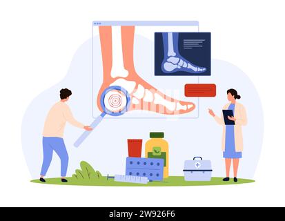 Artrite reumatoide, osteoartrite, diagnosi e trattamento dei reumatismi, illustrazione dei vettori reumatologici. Cartone animato la ricerca di persone minuscole raggi x di pazienti piede con lente di ingrandimento in ospedale Illustrazione Vettoriale