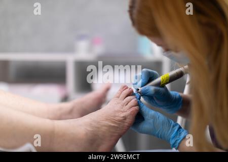 Primo piano dei piedi di una donna che è venuta per un appuntamento da podiatra. Foto Stock