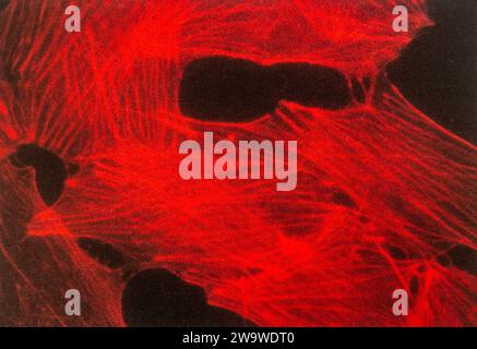 Microscopia fluorescente di cellule, in particolare fibroblasti, colorato con falloidina etichettata fluorescentemente mostrando fibre da stress actina Foto Stock