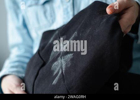 La mano di una donna mostra segni bianchi su macchie di deodorante in abiti neri. Vestiti rovinati. concetto di colorazione della vita quotidiana. Foto Stock