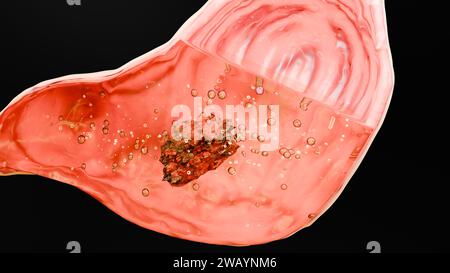 Stomaco umano anatomia digestione, esofago addome gastrico con digestivo acido, sezione trasversale isolata di organo interno, intestino gastrico, processo di Foto Stock