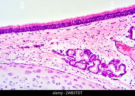 Epitelio colonnare pseudostratificato umano ciliato. Trachea X125 a 10 cm di larghezza. In basso a sinistra cartilagine con condrociti. Foto Stock