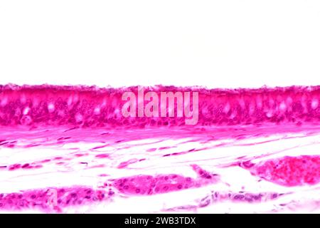 Epitelio colonnare pseudostratificato umano ciliato. Trachea X125 a 10 cm di larghezza. Foto Stock