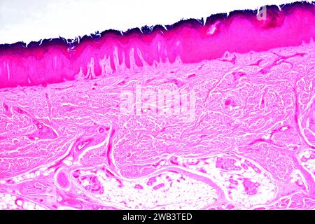 Epitelio squamoso stratificato dalla pelle umana della mano che mostra epidermide cheratinizzata e derma con tessuti connettivi. X25 a 10 cm di larghezza. Foto Stock