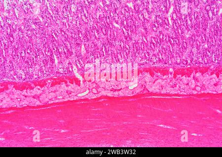 Intestino tenue umano (duodeno) che mostra dal basso verso l'alto: Fibre muscolari, sottomucosa e mucosa con cripte di Lieberkhun. X75 a 10 cm di larghezza. Foto Stock