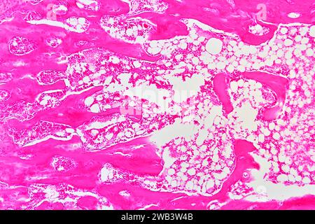 Midollo osseo rosso umano, tessuto ematopoietico. X75 a 10 cm di larghezza. Foto Stock