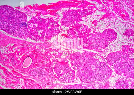 Mucosa del cordone ombelicale umano che mostra: Ghiandole mucose, tessuto conettivo sciolto, adipociti, fibre muscolari lisce e vasi sanguigni. X25 a 10 cm di larghezza. Foto Stock