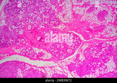 Mucosa del cordone ombelicale umano che mostra: Ghiandole mucose, tessuto conettivo sciolto, adipociti, fibre muscolari lisce e vasi sanguigni. X25 a 10 cm di larghezza. Foto Stock