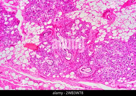 Mucosa del cordone ombelicale umano che mostra: Ghiandole mucose, tessuto conettivo sciolto, adipociti, fibre muscolari lisce e vasi sanguigni. X25 a 10 cm di larghezza. Foto Stock