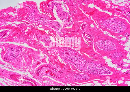 Mucosa del cordone ombelicale umano che mostra: Ghiandole mucose, tessuto conettivo sciolto, adipociti, fibre muscolari lisce e vasi sanguigni. X75 a 10 cm di larghezza. Foto Stock