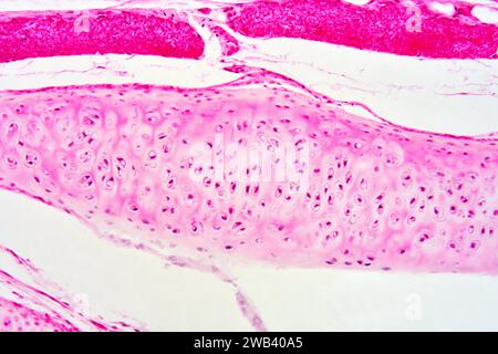 Trachea umana con cartilagine ialina. X125 a 10 cm di larghezza. Foto Stock