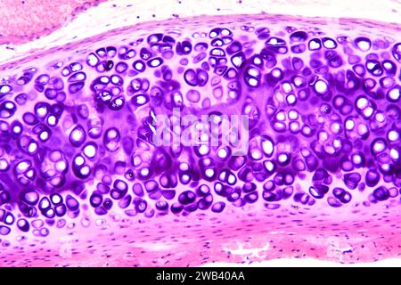Cartilagine ialina umana. X125 a 10 cm di larghezza. Foto Stock
