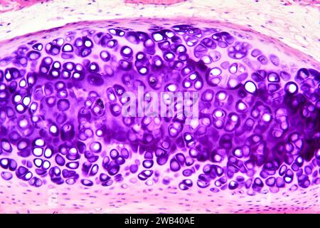 Cartilagine ialina umana. X125 a 10 cm di larghezza. Foto Stock