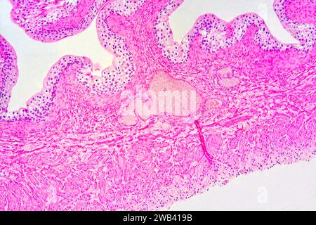 Vescica urinaria con urotelio (epitelio transitorio), tessuto connettivo e fibre muscolari lisce. Fotomicrografo X75 con larghezza di 10 cm. Foto Stock