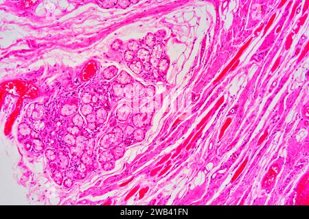 La ghiandola parotide è la ghiandola salivare più grande. Possiamo