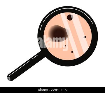 Diagnosi di melanoma prevenzione del cancro cutaneo illustrazione vettoriale Illustrazione Vettoriale