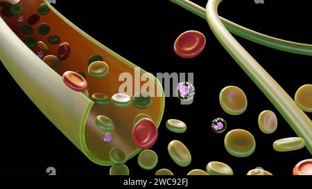 Sulfemoglobinemia, una condizione caratterizzata da livelli anormalmente elevati di sulfemoglobina (SulfHb) nel sangue, può causare la comparsa di verde nel sangue Foto Stock