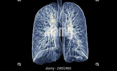 Immagine di rendering TC toracica o polmonare 3d che mostra trachea e polmoni nel sistema respiratorio. Foto Stock