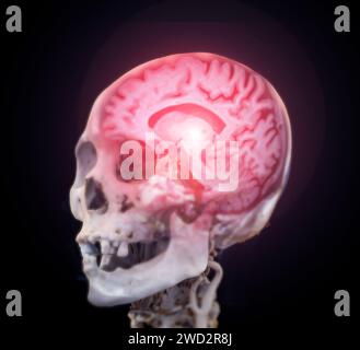 MRI Brain Scans fusion with Skull 3D rendering (RM cerebrale). Foto Stock