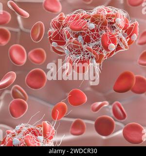 Coagulo di sangue, illustrazione Foto Stock