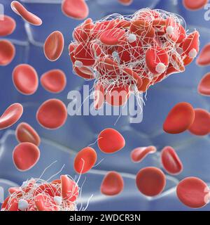 Coagulo di sangue, illustrazione Foto Stock