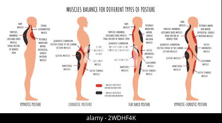 Confronto dello squilibrio muscolare in vari disturbi posturali. Infografiche sulla postura Kyphotic, lordotic, flat back back. La vista laterale mostra caratteristiche allungate e indebolite, accorciate e scuote i muscoli Illustrazione Vettoriale