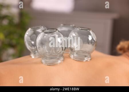 Terapia di coppettazione. Vista ravvicinata della donna con tazze di vetro sul retro al chiuso Foto Stock