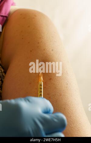 Primo piano del braccio di una donna vaccinata con guanti in lattice blu Foto Stock