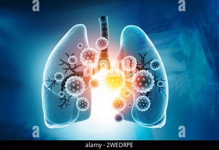 Infezioni polmonari virali, infezione polmonare conept. illustrazione 3d. Foto Stock