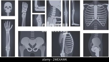 Shot a raggi X. Radiologia del corpo umano di testa, ossa delle mani, colonna vertebrale e gabbia toracica Illustrazione Vettoriale