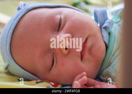 il bambino giace in una culla con brufoli e dorme Foto Stock