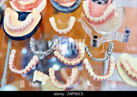 Protesi dentarie in mostra presso un negozio di odontoiatria Foto Stock