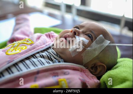 29 gennaio 2024 Sylhet, Bangladesh: Un bambino in cura per problemi respiratori al Sylhet MAG Osmani Medical College Hospital. I bambini di età compresa tra i sei mesi e l'anno e mezzo si precipitano in ospedale con polmonite e complicazioni da broncopolmonite. Il 29 gennaio 2024 Sylhet, Bangladesh (Credit Image: © MD Rafayat Haque Khan/eyepix via ZUMA Press Wire) SOLO PER USO EDITORIALE! Non per USO commerciale! Foto Stock