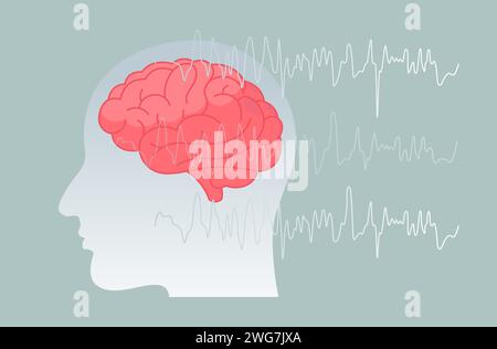 Epilessia - Una condizione neurologica - Stock Illustration as EPS 10 file Illustrazione Vettoriale