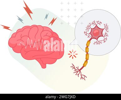 Epilessia - Una condizione neurologica - Stock Illustration as EPS 10 file Illustrazione Vettoriale