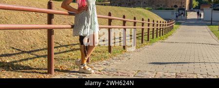 Bella giovane donna amputata in un abito che cammina nel parco durante il giorno di sole. La vita va avanti in ogni caso. Foto Stock