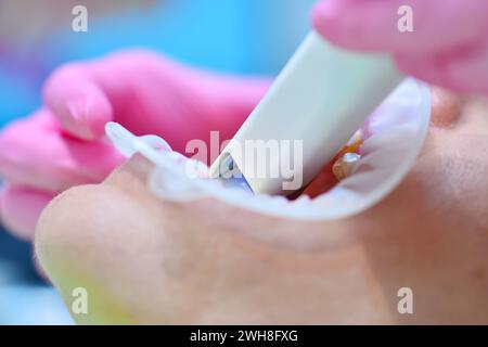 Donna dentista con guanti rosa che utilizza uno scanner intraorale dentale durante l'esame dei denti del paziente in una clinica odontoiatrica. Scansione intraorale con apparecchio di scansione c Foto Stock