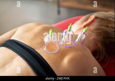 Donna anonima che riceve un trattamento di coppettazione mentre è sdraiata in barella in clinica con una fila di coppe sottovuoto per massaggi sulla schiena Foto Stock