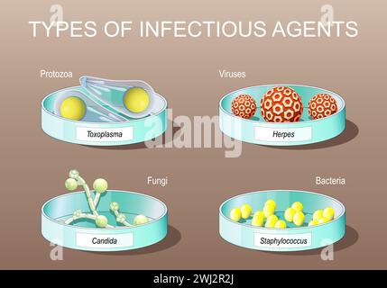 Tipi di agenti infettivi. agenti patogeni. Protozoi parassiti. Virus, batteri, funghi e organismo unicellulare. Piatti di Petri con Candida albicans, lei Illustrazione Vettoriale