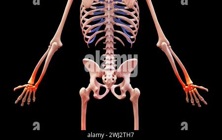 illustrazione in 3d di uno scheletro umano con dolore al polso Foto Stock