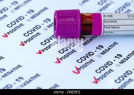 Rapporto di rilevamento della malattia di Covid-19 e provetta di test con sangue reale. Casella di controllo COVID 19 per positivo B. Foto Stock