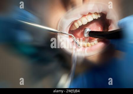 Dentista che perfora il dente al paziente di sesso maschile sulla sedia dentale con effetto di sfocatura del movimento Foto Stock