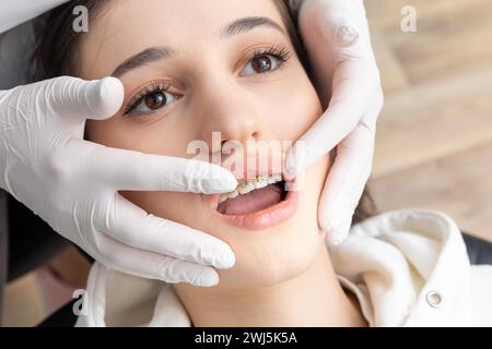 Primo piano delle staffe di controllo ortodontiche sui denti femmina. Concetto di stomatologia, odontoiatria, trattamento ortodontico delle bretelle Foto Stock