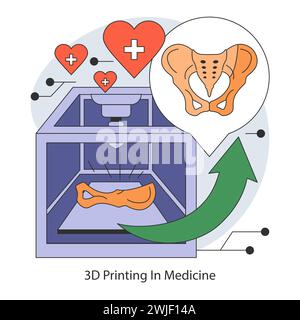 Concetto di stampa medica 3D. Trasformazione della cura del paziente con strutture ossee e modelli di organi stampati su misura. L'intersezione tra salute e high-tech. Illustrazione vettoriale piatta. Illustrazione Vettoriale