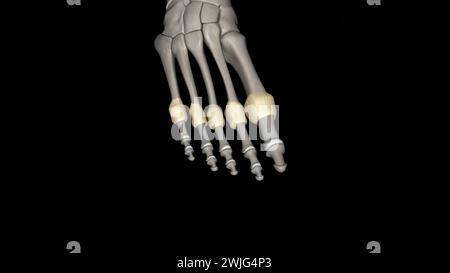 Capsula articolare metatarsofalangea 3d medico Foto Stock