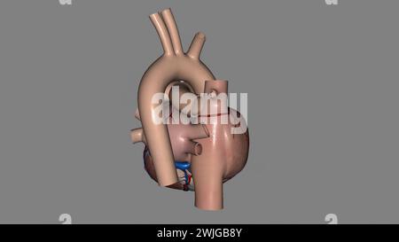 Anatomia cardiaca (esterna) superficie anteriore o sterenocostale: Principalmente l'illustrazione 3d del ventricolo destro Foto Stock