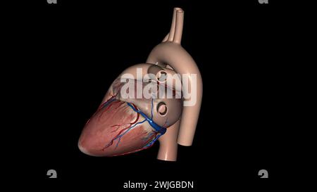 Anatomia cardiaca (esterna) superficie anteriore o sterenocostale: Principalmente l'illustrazione 3d del ventricolo destro Foto Stock